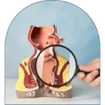 obat wasir